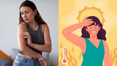 Heat rash to dehydration: BEWARE of these 6 summer skin problems