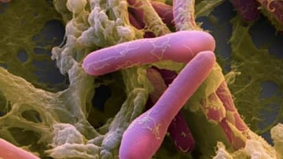 ഭക്ഷ്യ വിഷബാധയേറ്റ് 28 പേർ തീവ്രപരിചരണ വിഭാഗത്തിൽ, കാരണം ക്ലോസ്ട്രീഡിയം ബോട്ടുലിനം ബാക്ടീരിയ, സംഭവം റിയാദിൽ