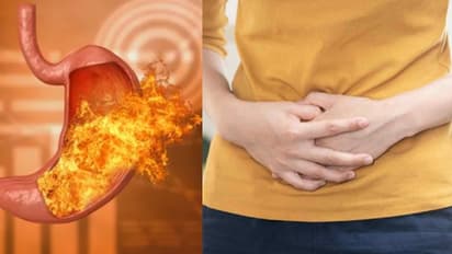 വയറിലെ അള്സറിനെ അകറ്റാന് ഡയറ്റില് ഉള്പ്പെടുത്താം ഈ ഭക്ഷണങ്ങള്