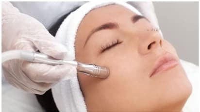 എന്താണ് വാമ്പയര് ഫേഷ്യല്? സുരക്ഷിതമാണോ?