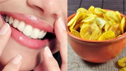 ഈ എട്ട് ഭക്ഷണങ്ങള് നിങ്ങളുടെ പല്ലുകളെ നശിപ്പിക്കും