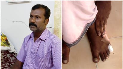 രക്തയോട്ടമില്ല, കഠിന വേദനയുമായി അഭിലാഷ്; ശസ്ത്രക്രിയക്ക് സുമനസ്സുകളുടെ സഹായം തേടുന്നു