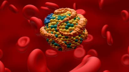 ചീത്ത കൊളസ്ട്രോള് കുറയ്ക്കാന് വീട്ടില് ചെയ്യേണ്ട കാര്യങ്ങള്