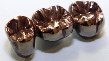 10 കൊല്ലം മോഷ്ടിച്ചത് ഒരേ വസ്തു, 25 കോടിയുണ്ടാക്കിയെന്ന് ദന്ത ഡോക്ടർ പൊലീസിനോട്