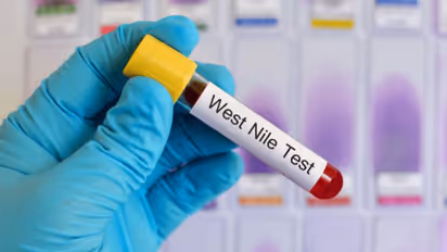 வெஸ்ட் நைல் காய்ச்சல் பரவல்: பொது மக்களுக்கு சுகாதாரத்துறை அறிவுறுத்தல்!