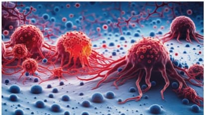 അവഗണിക്കരുത് ക്യാൻസറിന്റെ ഈ 10 ലക്ഷണങ്ങൾ 