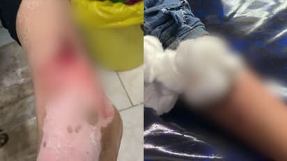 മൂവാറ്റുപുഴയില് 8 പേരെ ആക്രമിച്ച വളര്ത്തുനായക്ക് പേവിഷബാധ സ്ഥിരീകരിച്ചു; നഗരസഭയിൽ അടിയന്തര യോഗം