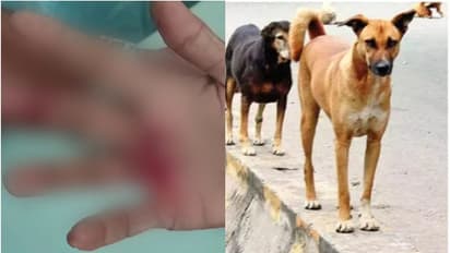 നാദാപുരത്ത് തെരുവുനായ ആക്രമണത്തിൽ രണ്ട് വയോധികർക്ക് പരിക്ക്; പ്രദേശത്ത് 3 മാസത്തിനിടെ  കടിയേറ്റത് 25 പേർക്ക്