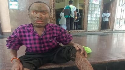 ಅಂದಗೆಟ್ಟ ದೇಹ: ಆಧಾರವಿಲ್ಲದೆ ಜೀವನವೇ ದುಸ್ತರ, ಕರುಣಾಜನಕ ಸ್ಥಿತಿಯಲ್ಲಿರುವ ಯುವಕ..!