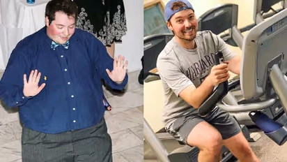 एक खबर ने इस मोटे डॉक्टर को बना दिया पतला और हैंडसम, Weight loss के लिए किया ये काम