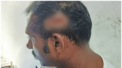 കഴക്കൂട്ടത്ത് ഉത്സവത്തിനിടെ സംഘർഷം; പൊലീസുകാരനെ കമ്പി കൊണ്ട് തലക്കടിച്ചു; 6 പേർ കസ്റ്റഡിയിൽ