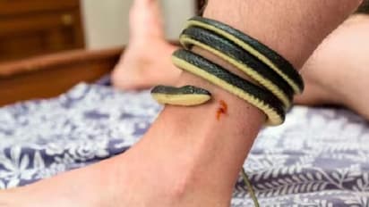 ಹಾವು ಕಚ್ಚಿದ ಕೂಡಲೇ ಮನುಷ್ಯ ಸಾಯೋದು ಹೇಗೆ..ವಿಷ ರಕ್ತಕ್ಕೆ ಸೇರಿದಾಗ ಏನಾಗುತ್ತದೆ?