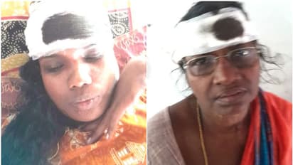 'കോഴി ഫാമിനെതിരെ പരാതി നല്‍കിയതില്‍ വൈരാഗ്യം'; വീട് കയറി ആക്രമണം; രണ്ട് പേര്‍ക്ക് പരുക്ക്