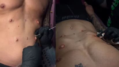 ಅಬ್ಬಬ್ಬಾ..ಏನೆಲ್ಲಾ ಮಾಡ್ತಾರಪ್ಪಾ, ಸರ್ಜರಿ ಮೂಲಕ ದೇಹದ ಮೇಲೆ ನಾಲ್ಕು ನಿಪ್ಪಲ್ ಸೇರಿಸಿಕೊಂಡ ವ್ಯಕ್ತಿ!