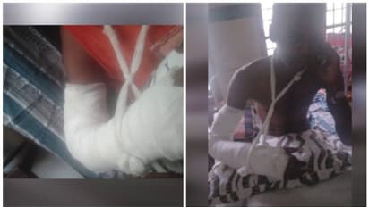 കോഴിക്കോട് മെഡിക്കൽ കോളേജിൽ വീണ്ടും ശസ്ത്രക്രിയ പിഴവ്; പരാതിയുമായി കോതിപ്പാലം സ്വദേശി