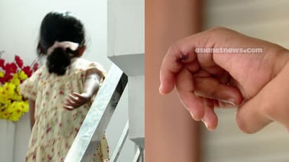 കോഴിക്കോട്ടെ അവയവം മാറി ശസ്ത്രക്രിയ കേസ്: പിഴവ് അന്വേഷിക്കാൻ മെഡിക്കൽ ബോര്‍ഡ് രൂപീകരിച്ചു