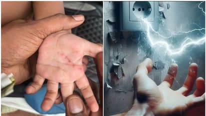 'ബൾബുകളും, ട്യൂബുകളും പൊട്ടിത്തെറിച്ചു, ഒന്നര വയസുകാരന് പരുക്ക്'; വീട്ടിൽ അമിതമായ വൈദ്യുത പ്രവാഹമെന്ന് പരാതി