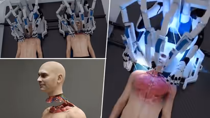 World's first head transplant system: US-based startup's spine-chilling, graphic video shocks Internet (WATCH)