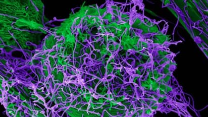 ಚೀನಾ ಲ್ಯಾಬ್‌ನಲ್ಲಿ ಮತ್ತೊಂದು ಮಾರಣಾಂತಿಕ ವೈರಸ್ ವಿನ್ಯಾಸಗೊಳಿಸಿದ ವಿಜ್ಞಾನಿಗಳು!