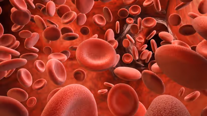 ഹീമോഫീലിയ രോഗികള് ഡയറ്റില് നിന്നും ഒഴിവാക്കേണ്ട ആറ് ഭക്ഷണങ്ങള്