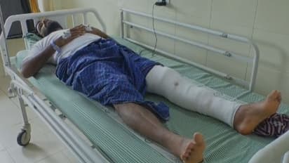 ബൈക്കിലേക്ക് കയറവെ റോഡരികിലെ പൊട്ടിയ സ്ലാബില്‍ കുടുങ്ങി യുവാവിന്‍റെ കാലൊടിഞ്ഞു