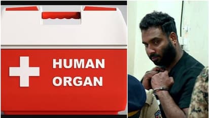 രാജ്യാന്തര അവയവക്കടത്തിൽ പങ്ക്, ഇറാനിലുള്ള മലയാളിയെ കണ്ടെത്താൻ അന്വേഷണസംഘം; ബ്ലു കോർണർ നോട്ടീസ് ഇറക്കുo 