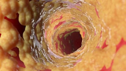 ചീത്ത കൊളസ്ട്രോൾ കുറയ്ക്കാൻ സഹായിക്കുന്ന ഒമ്പത് ശീലങ്ങൾ  