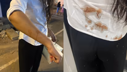 Bengaluru woman claims auto-driver spat tobacco on her; Internet reacts 