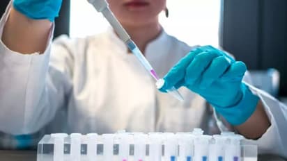 ಏವಿಯನ್ ಸೋಂಕಿನಿಂದ ಮೆಕ್ಸಿಕನ್ ವ್ಯಕ್ತಿ ಸಾವು, ವಿಶ್ವದಲ್ಲೇ ಮೊದಲ ಪ್ರಕರಣ; WHO ಎಚ್ಚರಿಕೆ