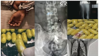 ഉദ്യോഗസ്ഥന് സംശയം, ബോഡി സ്കാനര് പരിശോധന; യാത്രക്കാരന്റെ കുടലിൽ കണ്ടെത്തിയത് 80 ലഹരിമരുന്ന് ക്യാപ്സ്യൂളുകൾ
