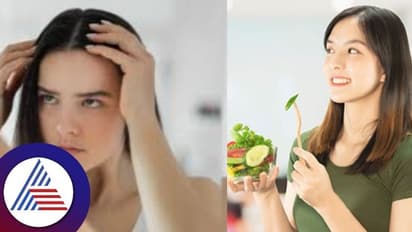 ಇನ್ನೂ 40 ಆಗಿಲ್ಲ, ಆಗ್ಲೇ ಬಿಳಿ ಕೂದ್ಲು ಶುರುವಾಯ್ತಾ? ಇದು ಇಲ್ಗೇ ನಿಲ್ಬೇಕಂದ್ರೆ ಈ ಆಹಾರ ತಿನ್ನಿ..