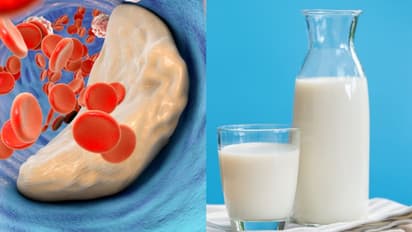 കൊളസ്ട്രോള് കുറയ്ക്കാന് ഡയറ്റില് ഉള്പ്പെടുത്താം ഈ നാല് തരം മില്ക്കുകള്