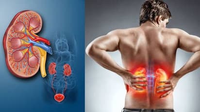 World Kidney Cancer Day:मोटापा भी करता है किडनी में वार, अनदेखी और लापरवाही से पनप सकता है किडनी कैंसर