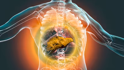 Health Tips: ലിവർ സിറോസിസ് രോഗികള്‍ ഡയറ്റില്‍ നിന്നും ഒഴിവാക്കേണ്ട ഭക്ഷണങ്ങള്‍ 