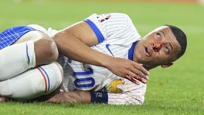 Euro 2024: France may be without Kylian Mbappe until quarter-finals after broken nose drama: Report