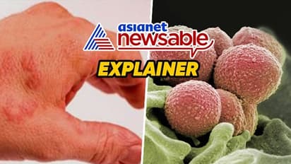Explained: What is STSS, deadly 'flesh-eating bacteria' spreading in Japan; will it affect rest of the world?