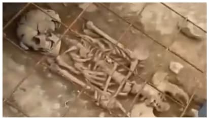 നൂറ്റാണ്ട് പഴക്കമുള്ള കുട്ടിയുടെ അസ്ഥികള് ഉപയോഗിച്ച് റീല്സിന് വേണ്ടി തമാശ; അയര്ലന്ഡില് വിവാദം