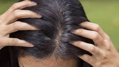 Youngsters have normalized premature grey hair, but why is it so common these days?