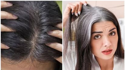  ಪ್ರಾಯಕ್ಕೆ ಮೊದಲೇ ಬರುವ ಬಿಳಿ ಕೂದಲಿಗೆ ವೀಳ್ಯದೆಲೆಯ ಪರಿಹಾರ: ಒಮ್ಮೆ ಟ್ರೈ ಮಾಡಿ