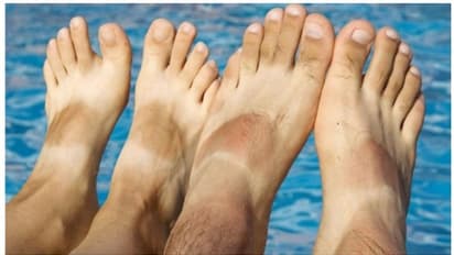 പാദങ്ങളിലെ സൺ ടാൻ എളുപ്പം അകറ്റാം ; പരീക്ഷിക്കാം ഈ പൊടിക്കെെകൾ