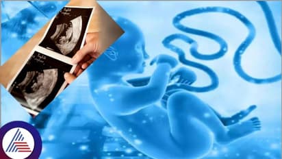 ಭ್ರೂಣ ಲಿಂಗಪತ್ತೆ ಬಗ್ಗೆ ಮಾಹಿತಿ ನೀಡುವವರಿಗೆ 1 ಲಕ್ಷ ರೂ. ಬಹುಮಾನ ಘೋಷಣೆ