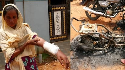 Chamarajanagar: ವರದಕ್ಷಿಣೆ ನೀಡಿಲ್ಲವೆಂದು ಅತ್ತೆಯ ಕೈ ಮುರಿದು ಬೈಕ್ಗಳಿಗೆ ಬೆಂಕಿ ಹಚ್ಚಿದ ಅಳಿಯ!