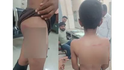 Bidar: ಹೋಮ್ವರ್ಕ್ ಮಾಡದ್ದಕ್ಕೆ ವಿದ್ಯಾರ್ಥಿಗೆ ರಕ್ತ, ಬಾಸುಂಡೆ ಬರುವಂತೆ ಥಳಿಸಿದ ಶಿಕ್ಷಕ!