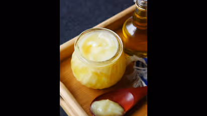 ತುಪ್ಪ ಆರೋಗ್ಯಕ್ಕೆ ಒಳ್ಳೆಯದು, ಆದ್ರೆ ಈ ಸಮಸ್ಯೆ ಇರೋರು ತಿನ್ನಲೇಬಾರದು?