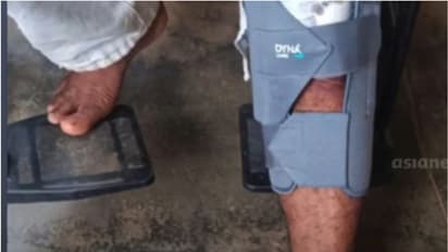 കാട്ടുപന്നി കുറുകെ ചാടി ബൈക്ക് യാത്രികന് പരിക്ക്; പ്രദേശത്ത് പന്നി ശല്യം രൂക്ഷം, നടപടി വേണമെന്ന് നാട്ടുകാര്