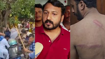 നീറ്റ് ചോദ്യപേപ്പർ ചോർച്ച; ദില്ലിയിലെ യൂത്ത് കോൺഗ്രസ് മാർച്ചിൽ സംഘർഷം, രാഹുല് മാങ്കൂട്ടത്തിലിനടക്കം പരിക്ക്