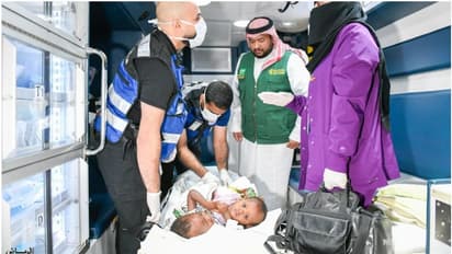 വേർപെടുത്തല് ശസ്ത്രക്രിയക്കായി ബുർക്കിനബെ സയാമിസ് ഇരട്ടകൾ റിയാദിലെത്തി