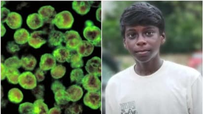 Kerala: Teenage boy dies of amoebic meningitis in Kozhikode; third death in two months