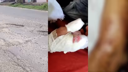 റോഡിലെ ഗട്ടറിൽ ഇറങ്ങി കെഎസ്ആർടിസി ബസിൻെറ ഡോർ തനിയെ തുറന്നു, റോഡിലേക്ക് തെറിച്ചുവീണ വിദ്യാർത്ഥിക്ക് പരിക്ക്