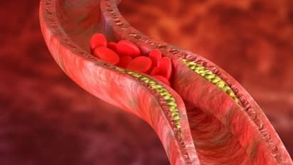 ഈ ചേരുവ മോശം കൊളസ്ട്രോൾ കുറയ്ക്കാൻ സഹായിക്കുമെന്ന് പഠനം